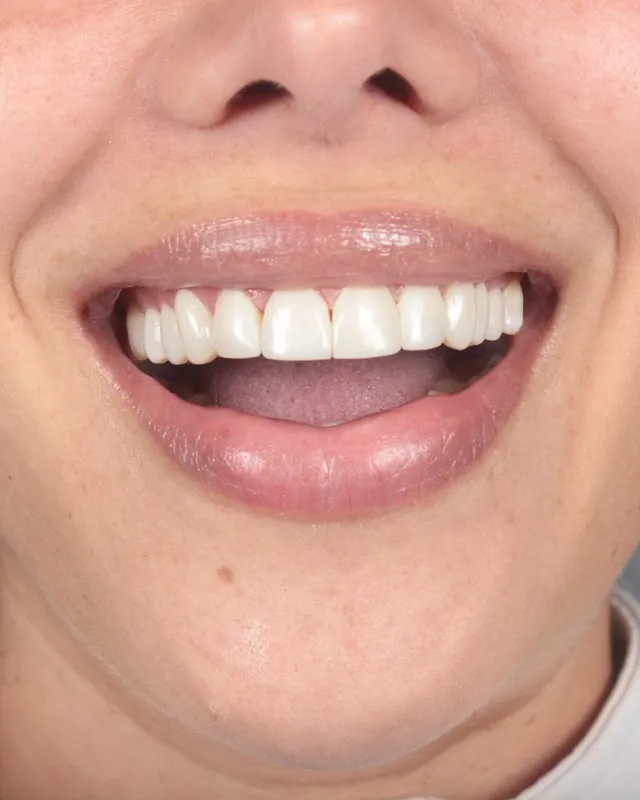 Paciente sonriendo después de su tratamiento